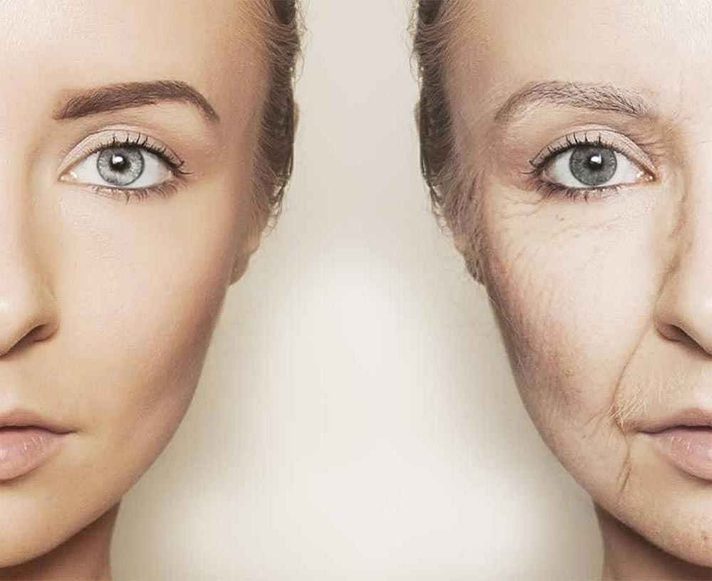 Fractional Thermolift
